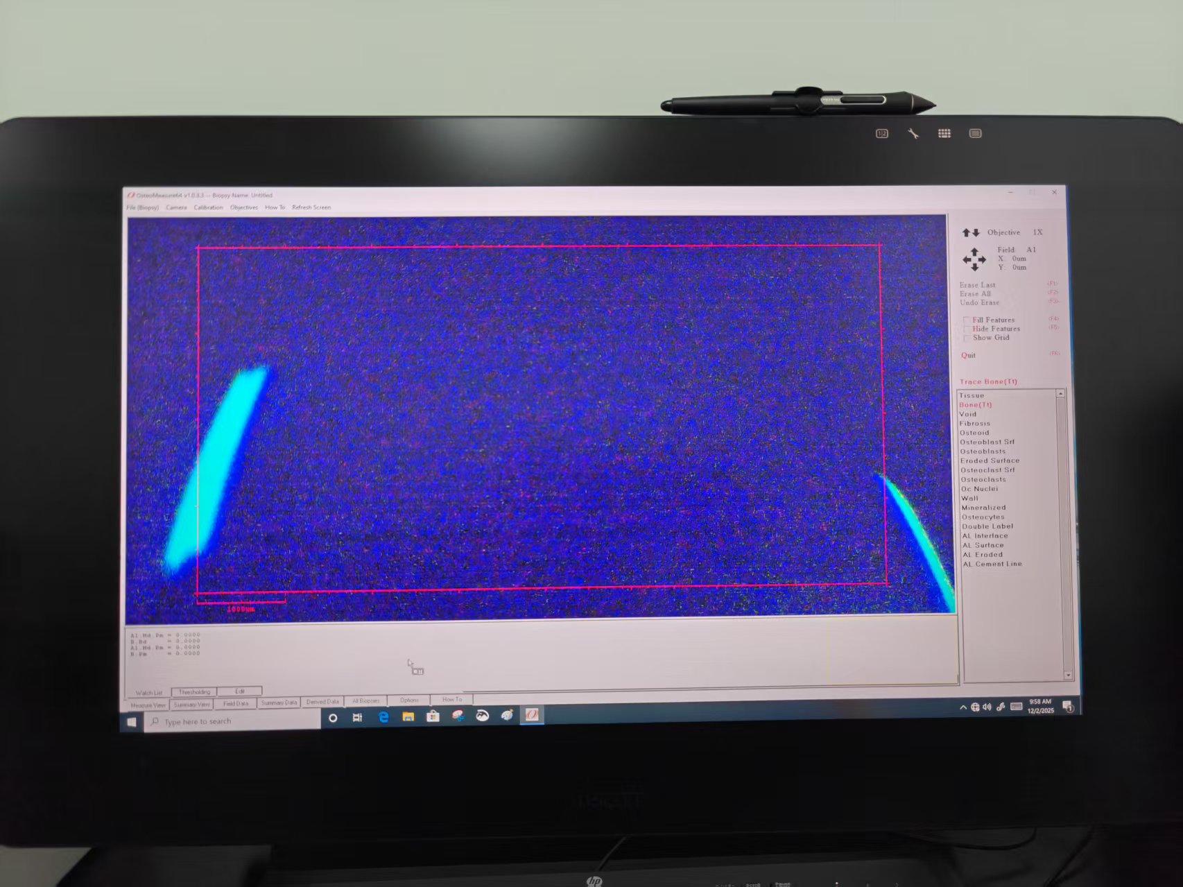 骨组织形态计量学